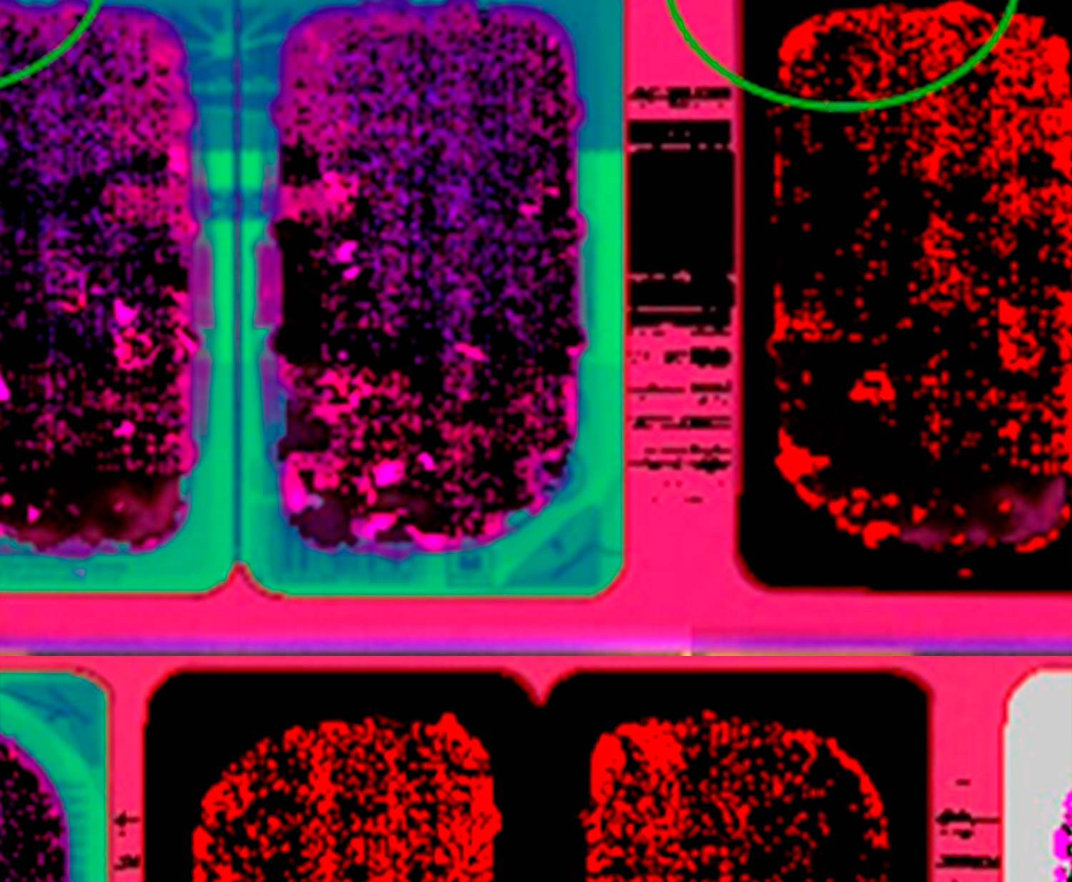 Tecnologia avançada per a la inspecció no destructiva en línia a la indústria càrnia